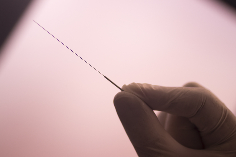 what is dry needling